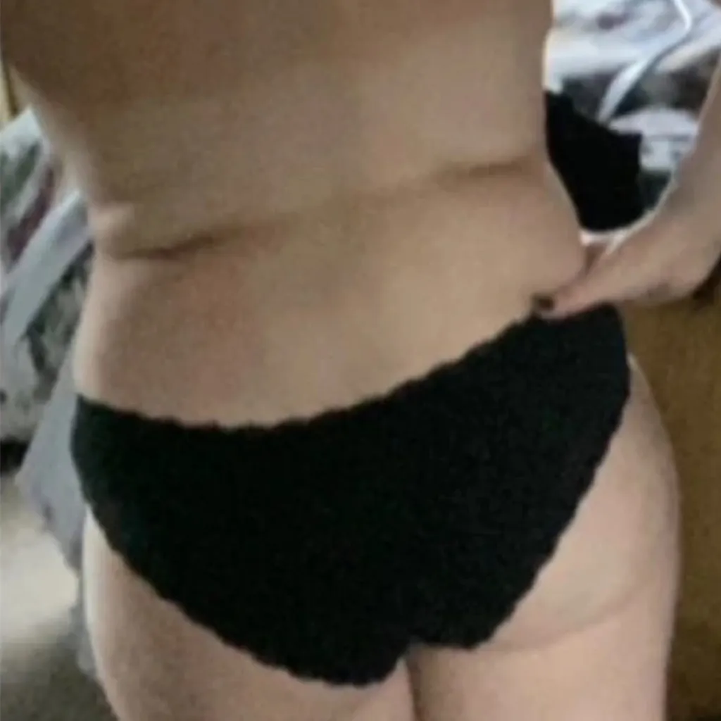 360° Liposuction Before